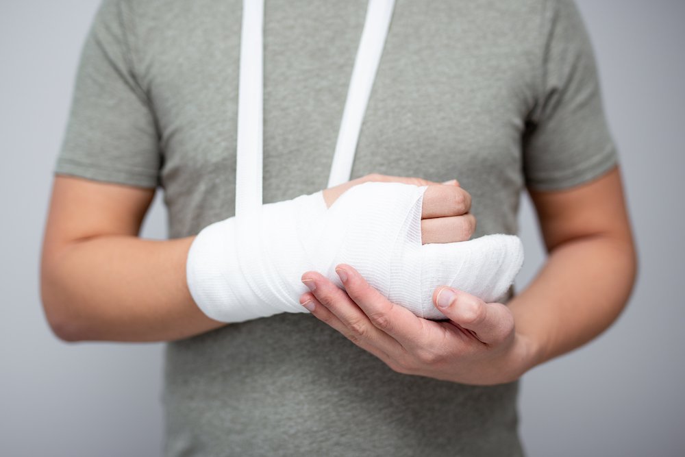 Child with broken bone